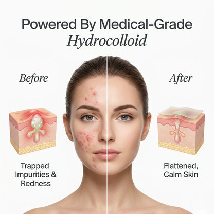 Cambie Hydrocolloid Roll - For Acne & Blemishes