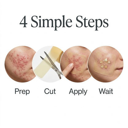 Cambie Hydrocolloid Roll - For Acne & Blemishes